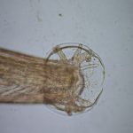 Detectan en Mallorca un gusano capaz de causar meningitis